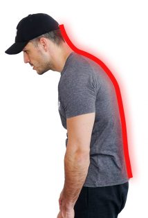 Bolečine v hrbtu lahko povzroča nepravilna drža