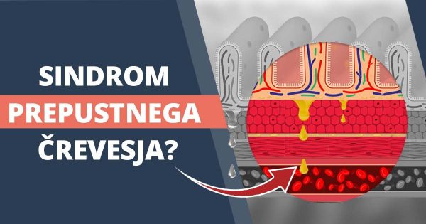 Sindrom prepustnega črevesja: tihi morilec tvojega zdravja
