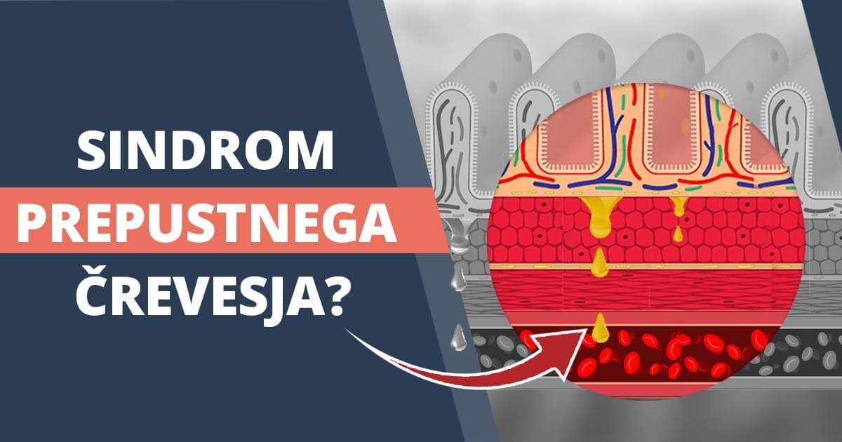 Sindrom prepustnega črevesja: tihi morilec tvojega zdravja