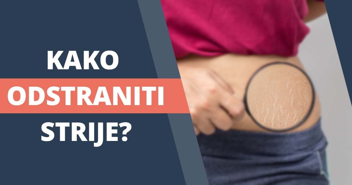 Strije bodo večne, razen če preizkusiš naslednje trike