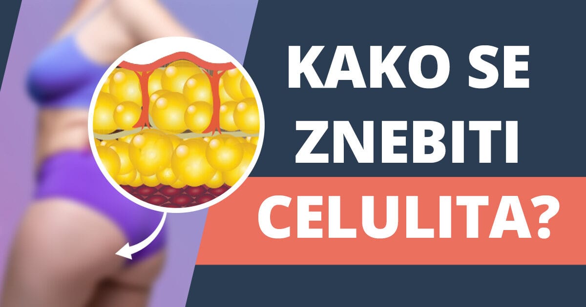 6 trikov, kako odpraviti celulit za vedno