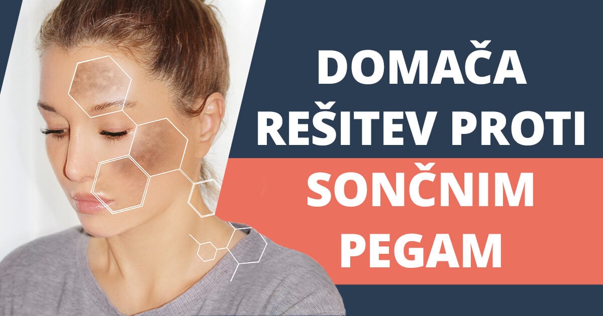 Sončne pege – kako preprečiti njihov nastanek?