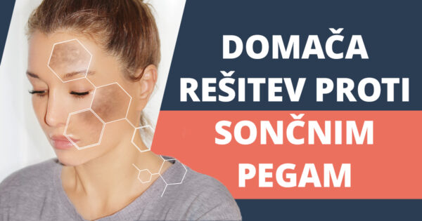 Sončne pege – kako preprečiti njihov nastanek?