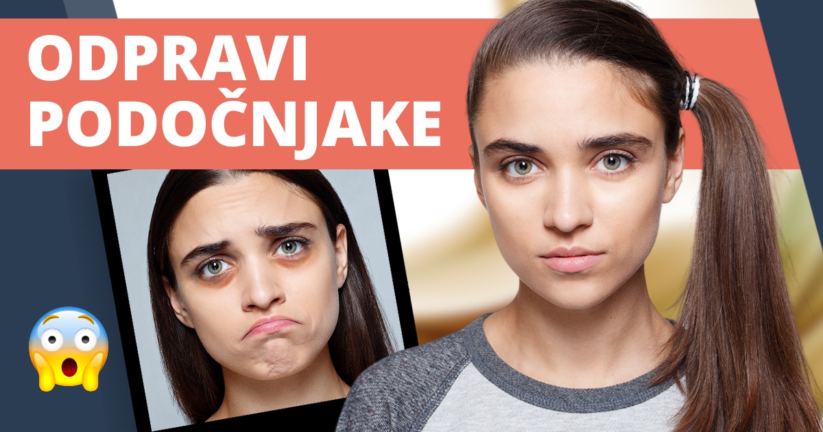 6 trikov, kako odpraviti podočnjake